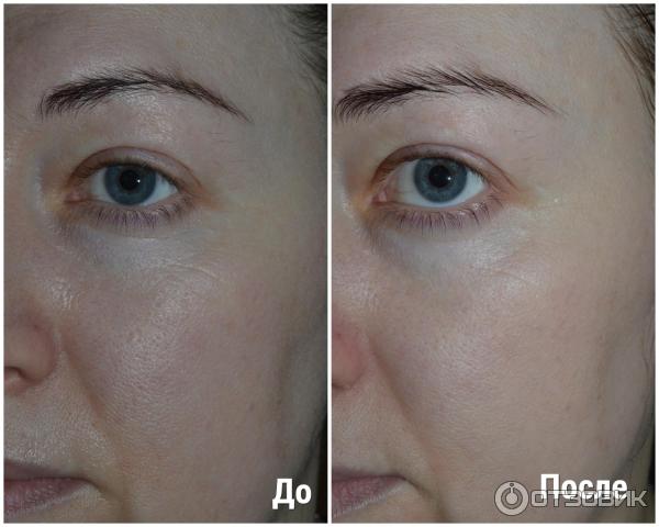 Минеральная успокаивающая маска Vichy фото