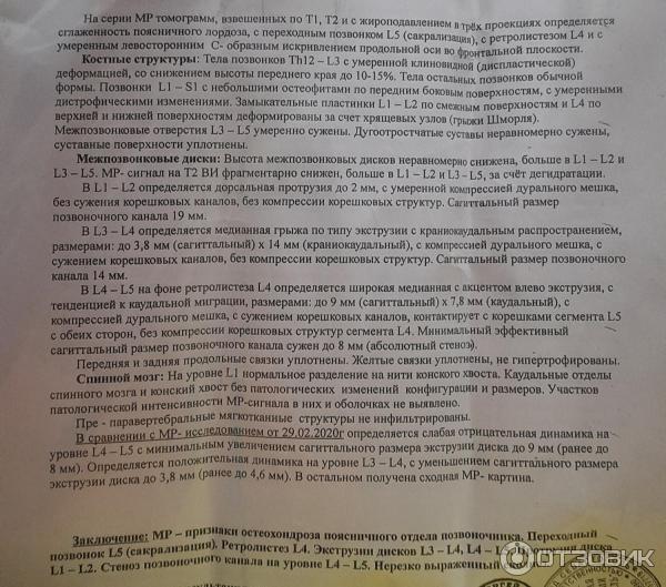 Отзыв о Массажер-тренажер Маст | Он реально работает и помогает при ...