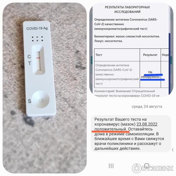 Антиген тесты covid 19 экспресс