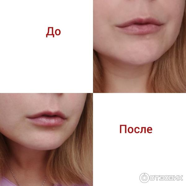 До и После