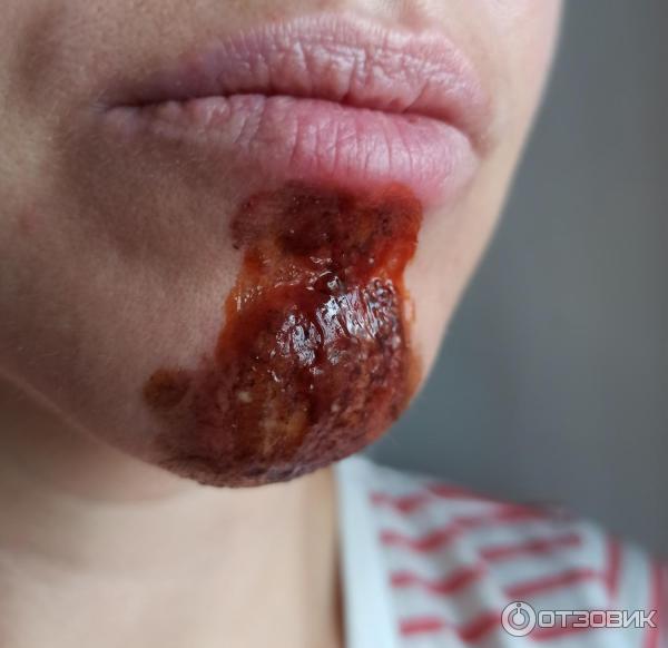 Мазь для наружного применения Фармпрепарат Стелланин