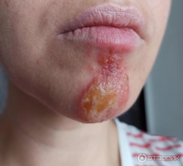 Мазь для наружного применения Фармпрепарат Стелланин