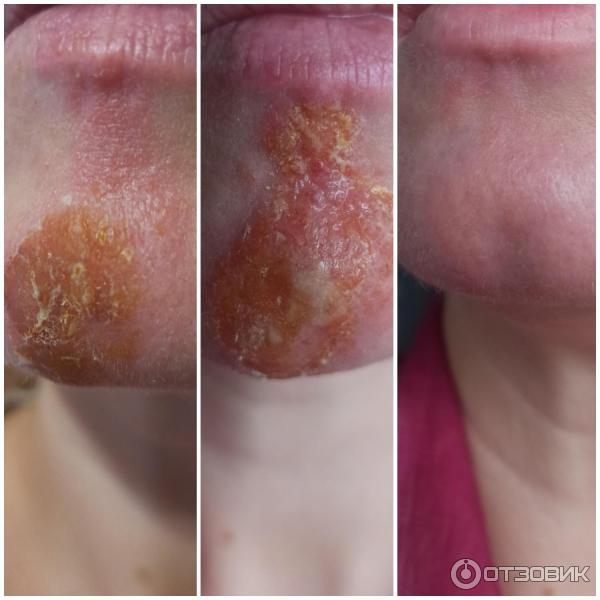 Мазь для наружного применения Фармпрепарат Стелланин