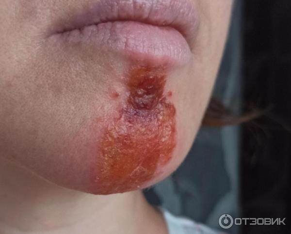 Мазь для наружного применения Фармпрепарат Стелланин