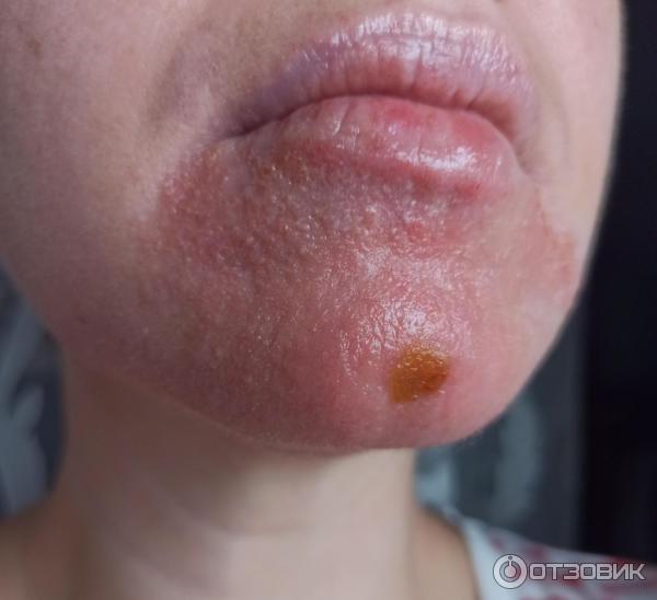 Мазь для наружного применения Фармпрепарат Стелланин