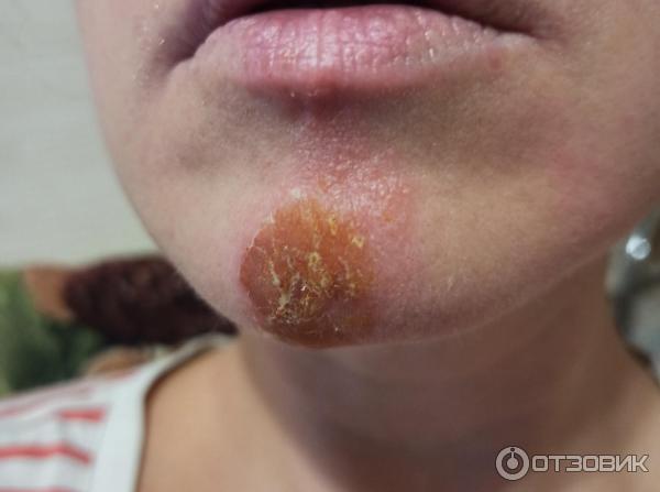 Мазь для наружного применения Фармпрепарат Стелланин