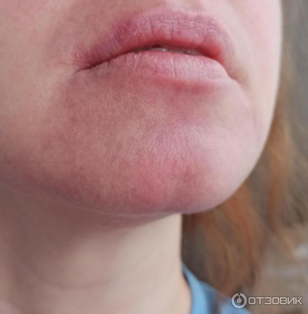 Мазь для наружного применения Фармпрепарат Стелланин