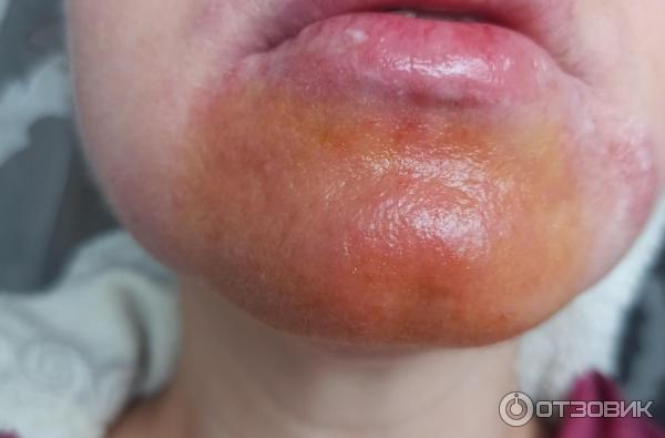 Мазь для наружного применения Фармпрепарат Стелланин