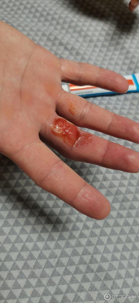 Мазь для наружного применения Фармпрепарат Стелланин фото