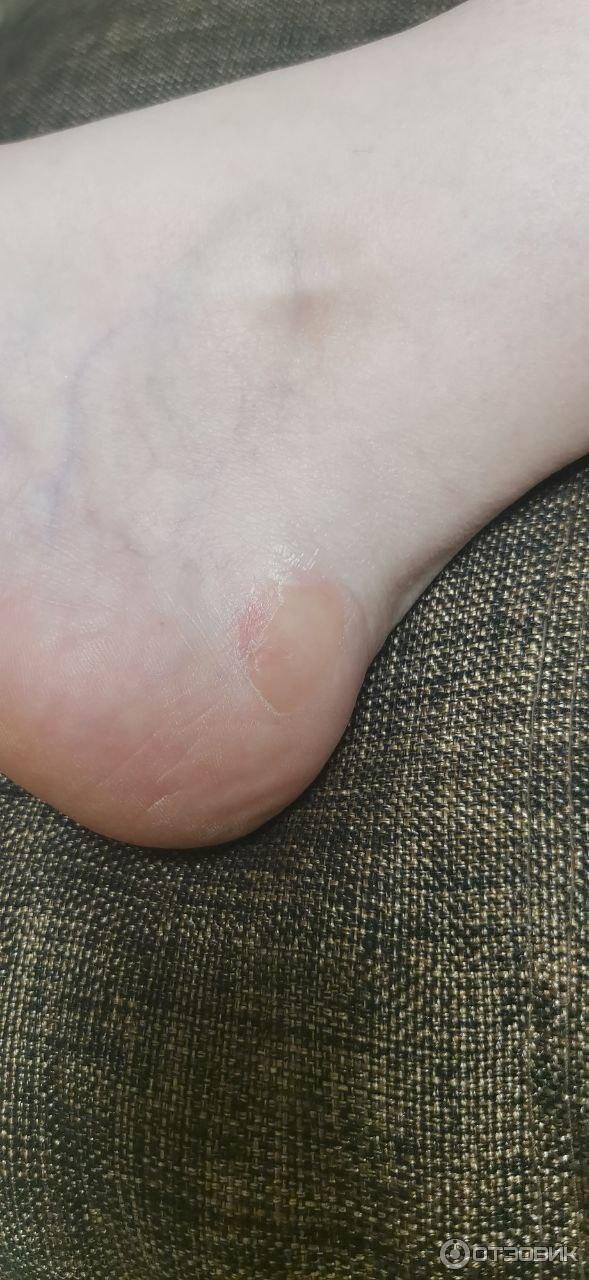 Мазь для наружного применения Фармпрепарат Стелланин фото