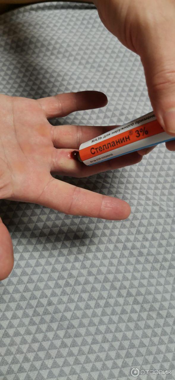 Мазь для наружного применения Фармпрепарат Стелланин фото