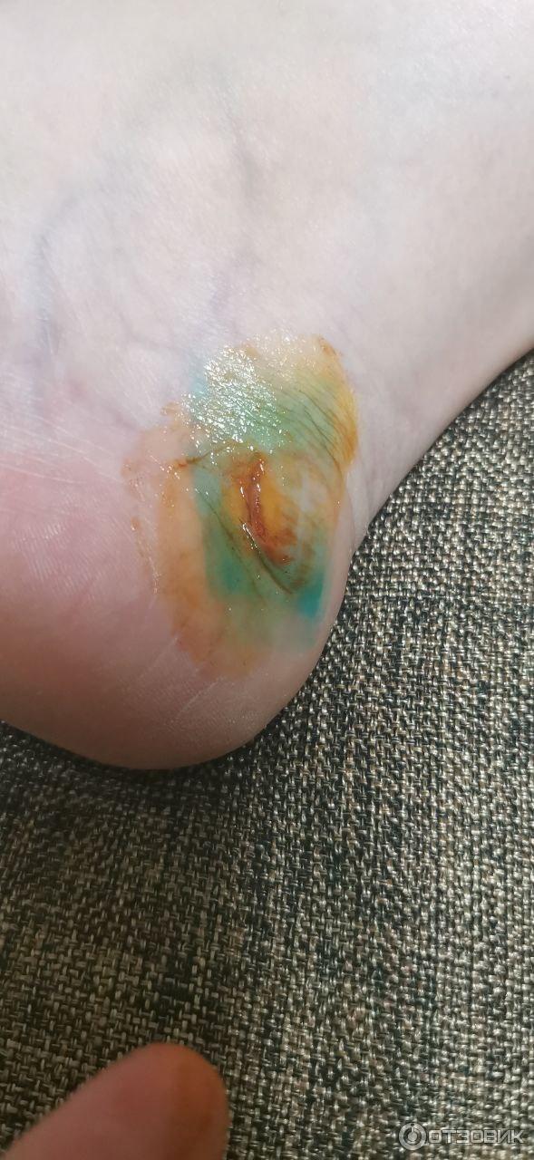 Мазь для наружного применения Фармпрепарат Стелланин фото