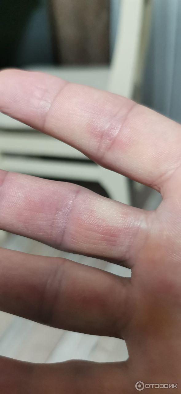 Мазь для наружного применения Фармпрепарат Стелланин фото