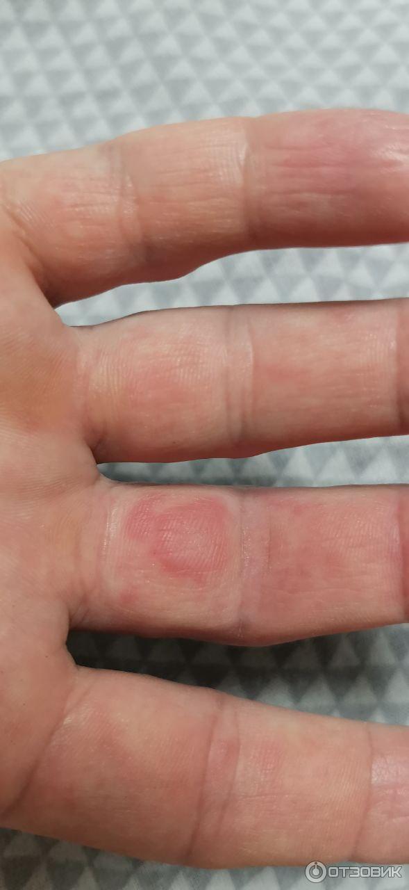 Мазь для наружного применения Фармпрепарат Стелланин фото