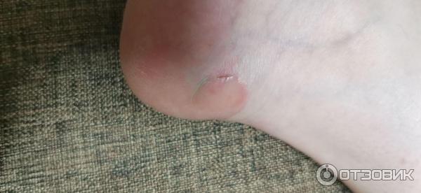 Мазь для наружного применения Фармпрепарат Стелланин фото