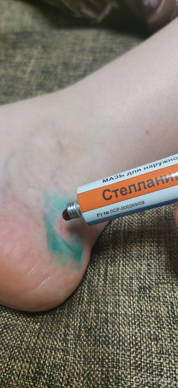Мазь для наружного применения Фармпрепарат Стелланин фото