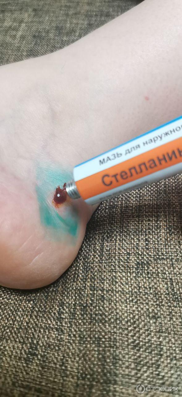 Мазь для наружного применения Фармпрепарат Стелланин фото