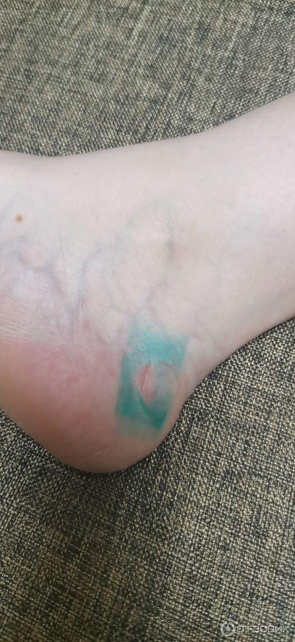 Мазь для наружного применения Фармпрепарат Стелланин фото