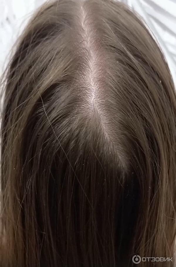 Шампунь-уход против перхоти Vichy без сульфатов для чувствительной кожи головы фото